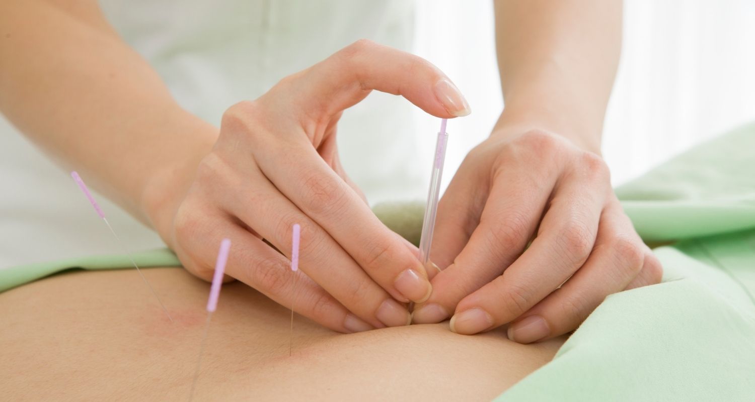 Things to Consider When Choosing an Acupuncturist | Fraser Life