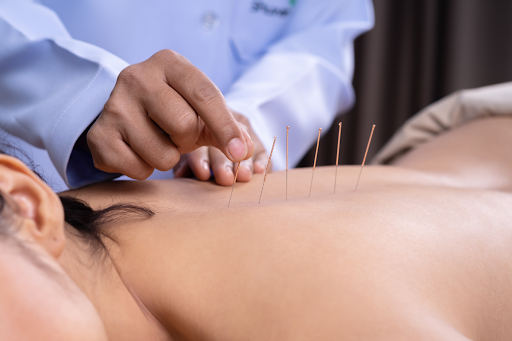 Choosing the Best Acupuncturist near Langley