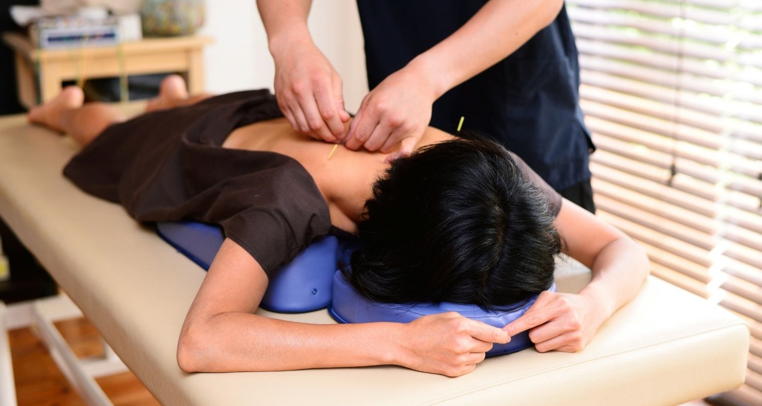 FAQs: Acupuncture From Fraser Life Physio and Rehab