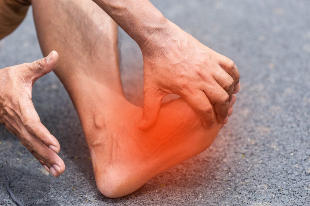 man suffering from plantar fasciitis