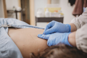 Acupuncture in Langley as a Treatment for Chronic Conditions